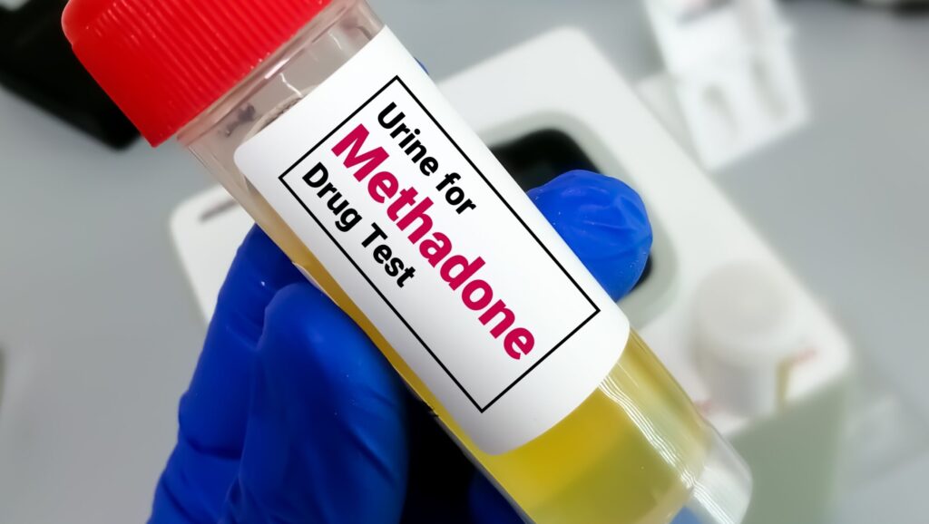 A person in blue gloves holds up a urine sample being tested for methadone representing how long it takes methadone to leave the system.