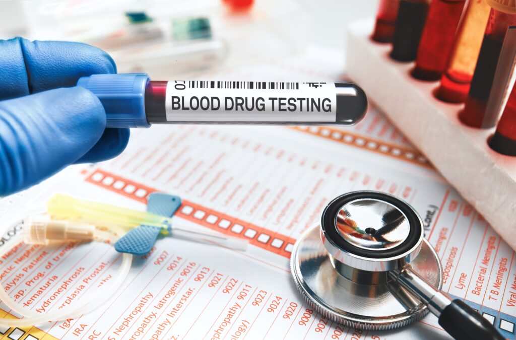 A clinician holding up a blood drug test over lab testing papers and a stethoscope testing how long cocaine stays in the blood.