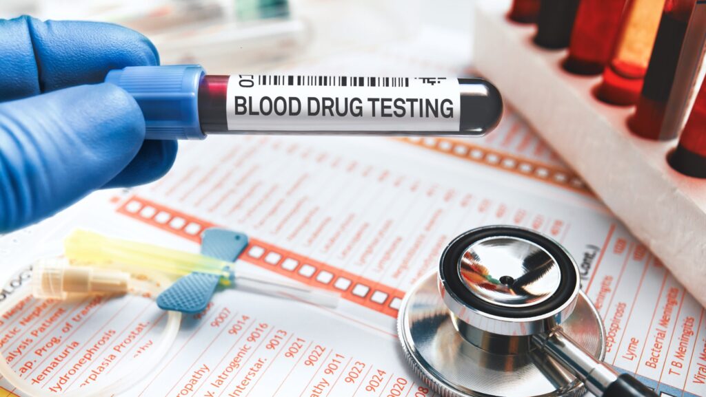 A clinician holding up a blood drug test over lab testing papers and a stethoscope testing how long cocaine stays in the blood.