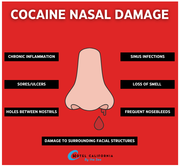 Infograph showing the side effects of cocaine nasal damage.