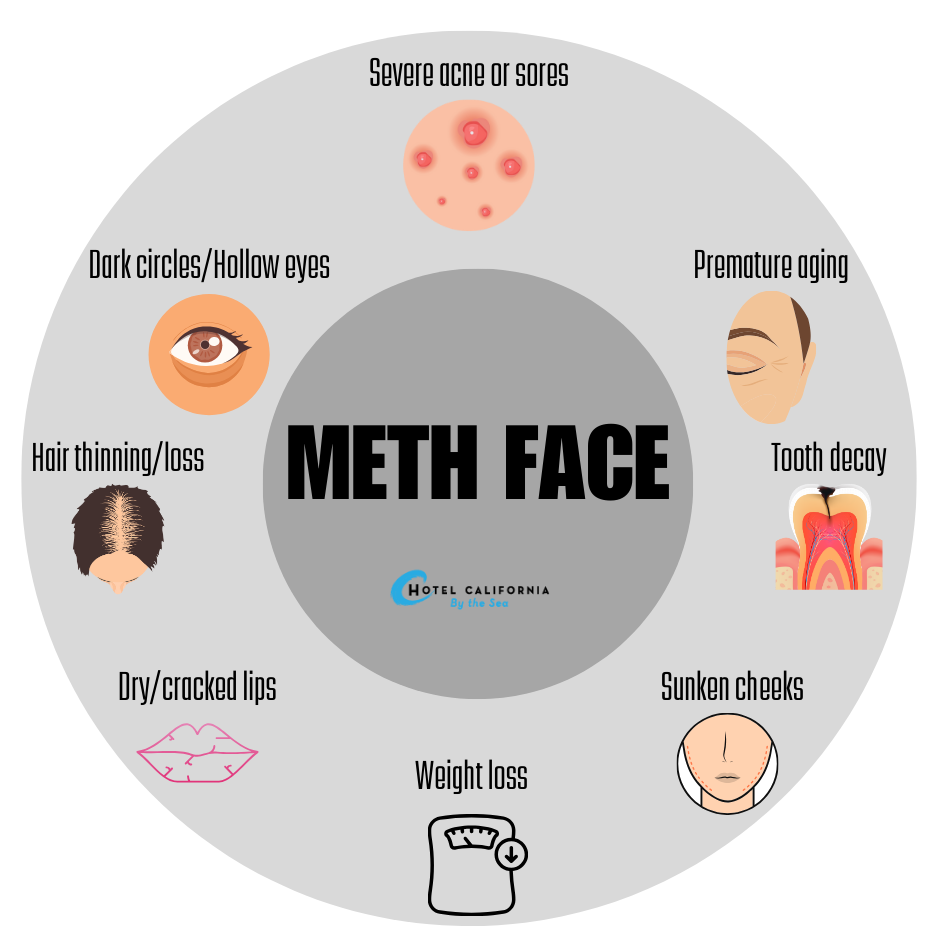 Infograph shows signs of meth face.