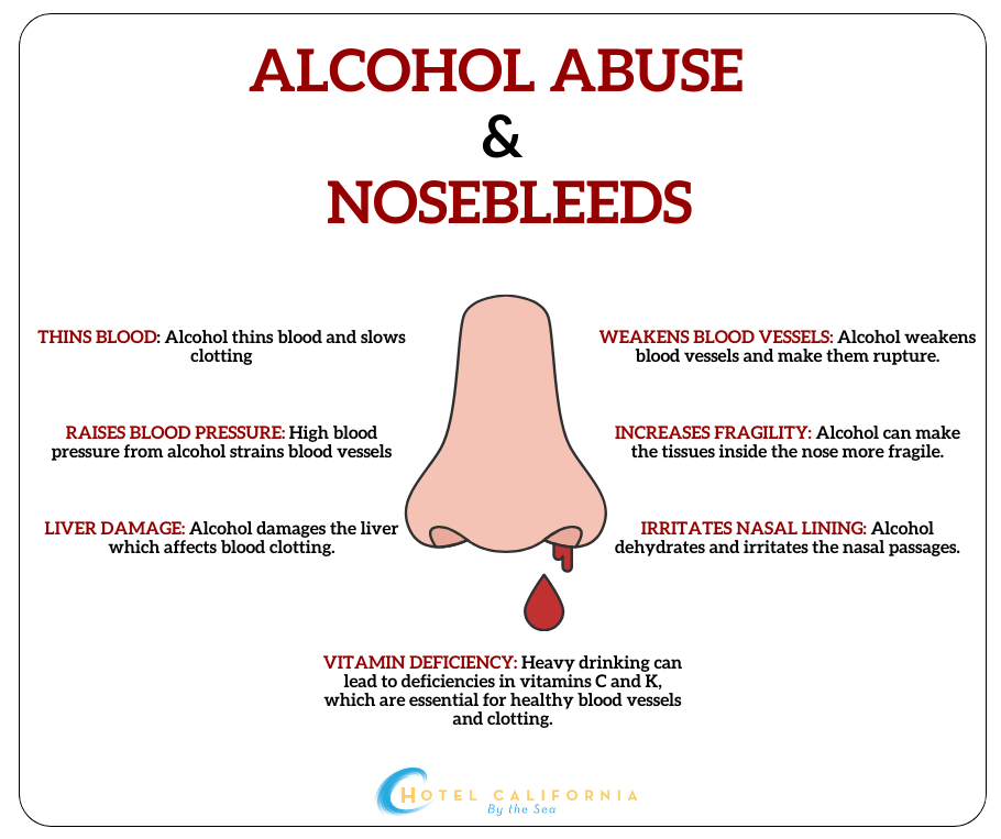 infograph showing the sings of alcohol induced nosebleeds.