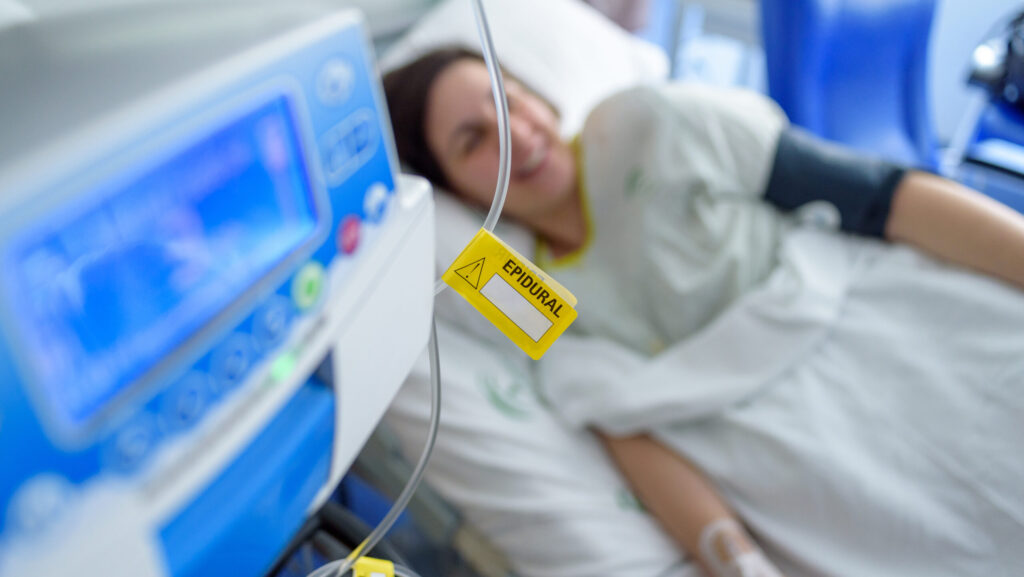 In a hospital setting a patient is laying in bed with an attached epidural IV line hanging near a machine.